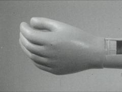 Die neuen Hände des Herrn Schwarze