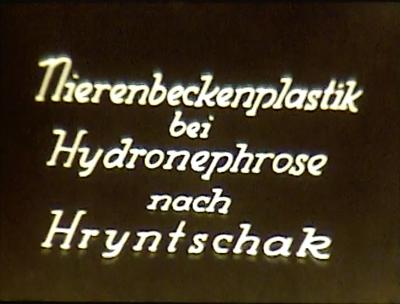 Nierenbeckenplastik bei Hydronephrose nach Hryntschak
