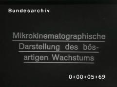 Mikrokinematographische Darstellung des bösartigen Wachstums
